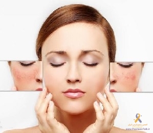 بهترین درمان برای رفع قرمزی پوست