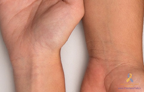 نوع مزاجتان را از رنگ پوست تشخیص دهید