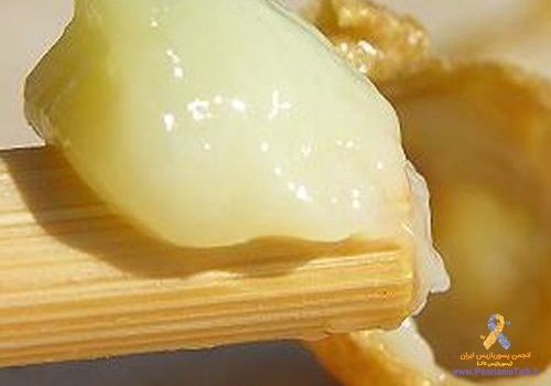 ژله رویال چیست؟