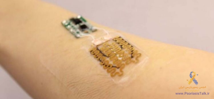 درمان زخم های مزمن با بانداژ هوشمند