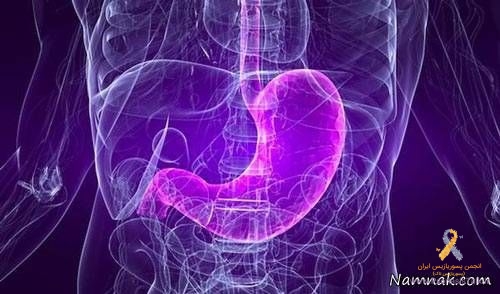 علائم و درمان سوء مزاج گرم کبد چیست؟