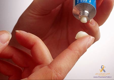 برخی روش های درمان پسوریازیس تناسلی