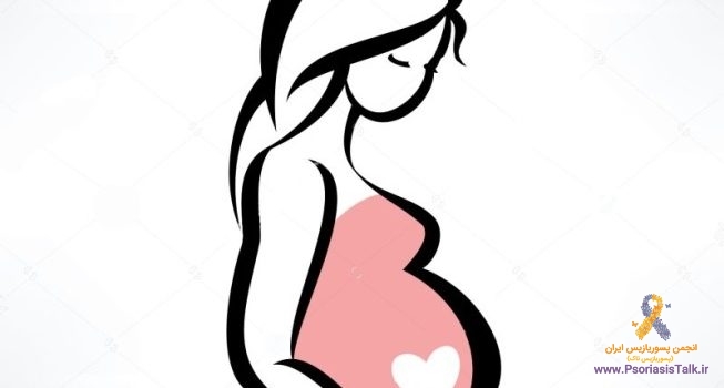 پسوریازیس و بارداری